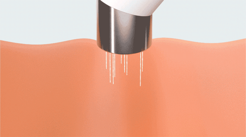qrc_1-17.gif